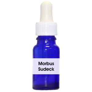 Sudeck (Morbus)